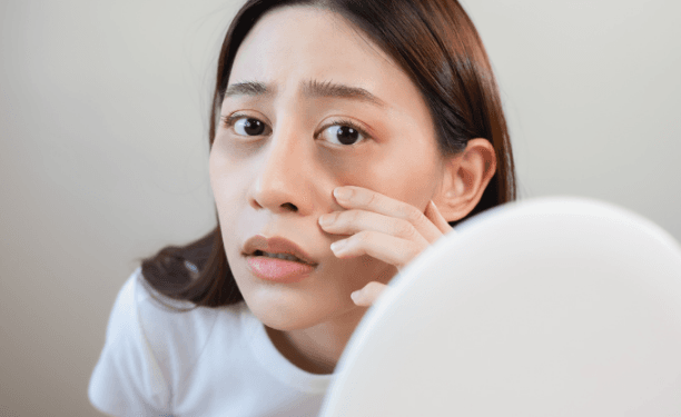 Cara Menghilangkan Kantung Mata