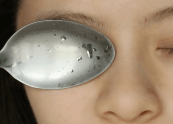 Cara Menghilangkan Mata Panda