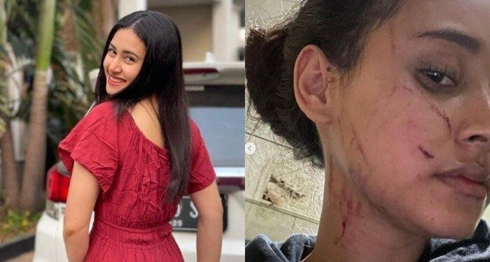 Afifah Riyad Diduga Alami KDRT? Muka Lebam hingga Luka Cakaran